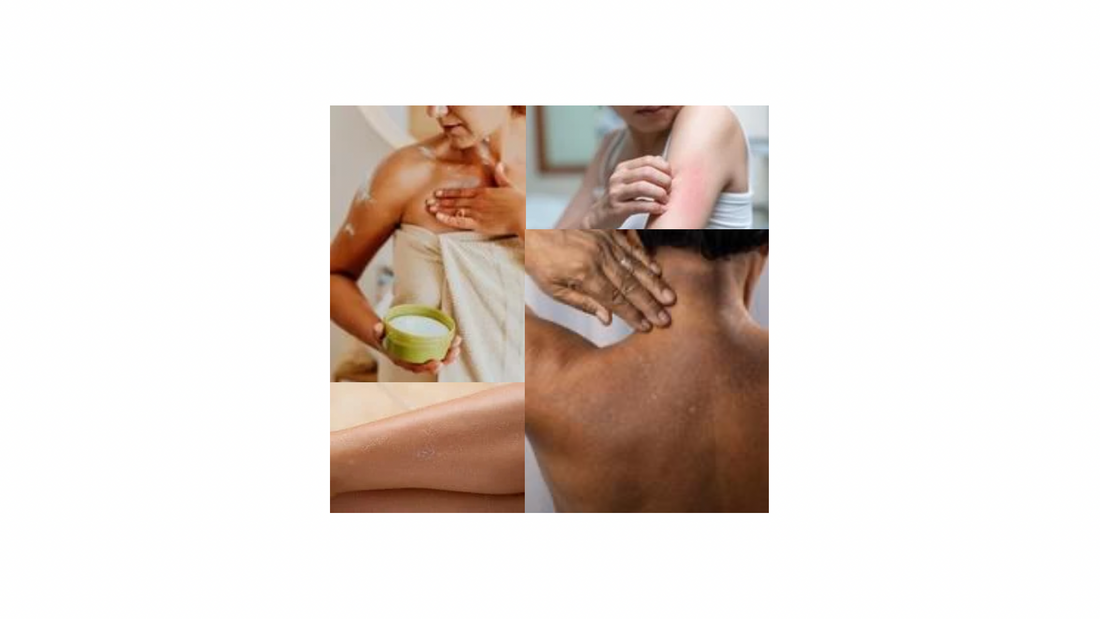 Burn‑out de la peau : Comment le stress quotidien et le multi‑rôles impacte votre peau et comment y remédier avec des soins naturels